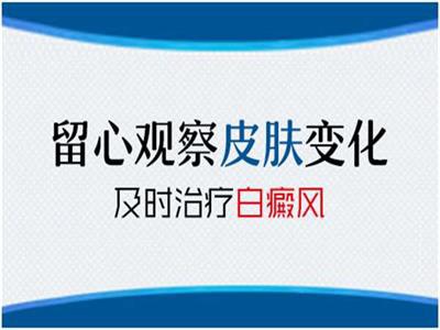 如何有效避免白癜风的扩散”