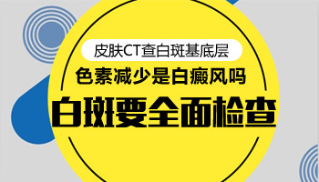 张家口检查白斑是不是白癜风做皮肤ct查的准吗”