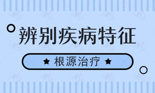 如何判断白癜风是否处在发展期呢”