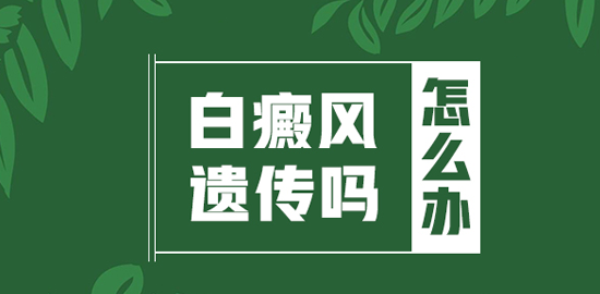 白癜风是不是会给遗传孩子”