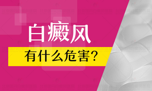 照伍德灯显示很明显的白色怀疑是白癜风准吗