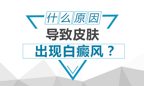 伍德灯下皮肤有白色块说明就是白癜风吗”