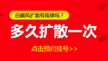 照伍德灯显示是白色百分百是白癜风吗”