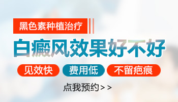 照伍德灯一小点点的白是白癜风吗？”