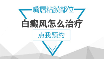 伍德灯下白斑是亮白色是白癜风吗”