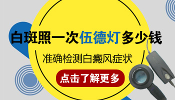 白癜风不扩散稳定期容易治疗吗