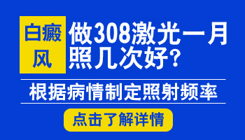 照伍德灯显示很明显的白色才是白癜风吗