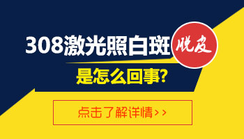 女性手上白癜风照光总不见效是什么情况