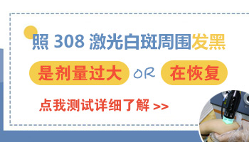 wood灯结果是荧光白能判断就是白癜风吗