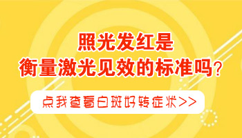 白癜风不扩散小块白斑该怎么治