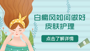 检查白斑是不是白癜风做伍德灯还是做ct”