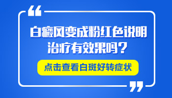 伍德灯检查手部早期白癜风能查出来吗”