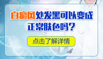 白癜风早期不明显照伍德灯能确诊吗”