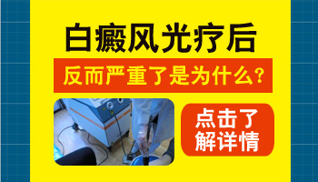 308激光治白癜风一个疗程多少钱