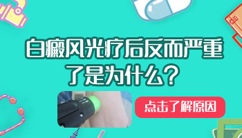 激光能治好白癜风吗 白癜风照308激光价格表