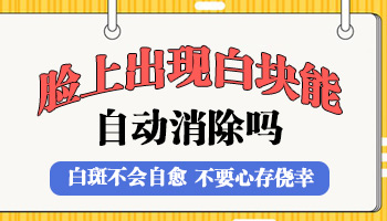 男性白癜风稳定期容易治疗吗