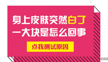 伍德灯下灰白色能判断就是白癜风吗