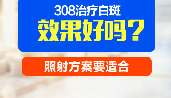 小孩手上大块白癜风治疗方法都有哪些”