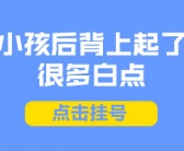 手上白癜风要怎么治疗好点”