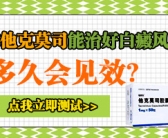 2022年治疗手上白癜风能不能恢复原来肤色”