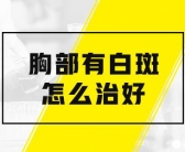 手上的白癜风初期能治好吗”