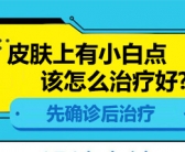 目前手部白癜风怎么治比较有效”