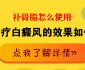 2022年治疗手上白癜风哪种治疗方法效果好”