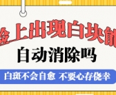 手上刚长白癜风可以治好吗”