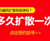 治疗手上白癜风要怎么治疗好点”