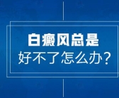 长在手上的白癜风目前治好的几率有多大”