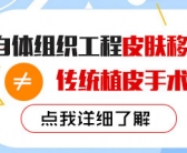 长在手上的白癜风用什么方法能快点治好”