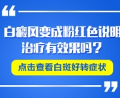 手上早期白癜风容易治好吗”