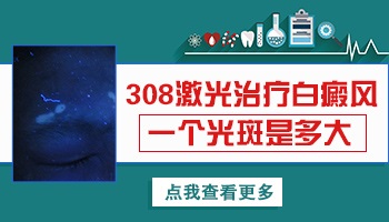 白癜风受心理因素影响大吗？”