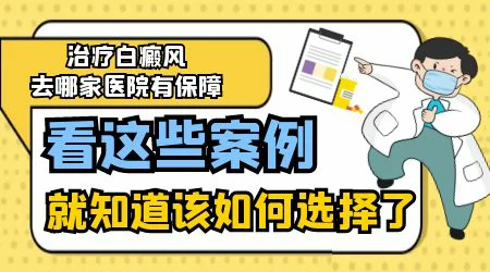 探索当前有效治疗小儿白癜风的方法