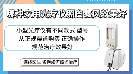 女性白癜风治疗应该怎么办”