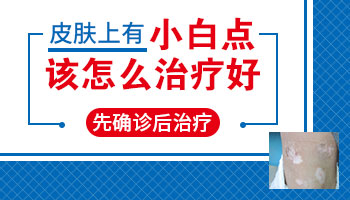 心理治疗如何助力白斑康复？