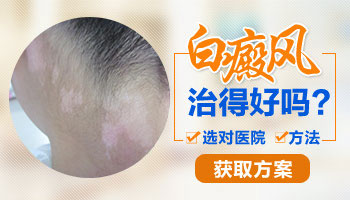 孩子身上长白斑，家长应该如何妥善应对？