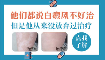 婴儿大腿内侧皮肤不规则发白？这里有你想要的答案！