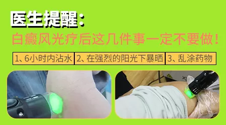 探索更优方案：如何有效治疗儿童白癜风？