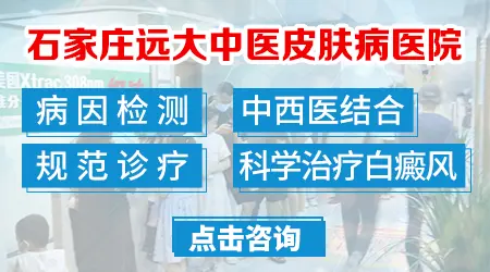 儿童面部有指甲大白癜风怎么治好”