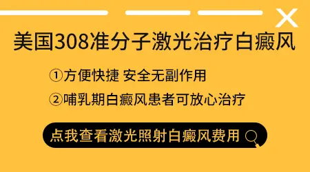 探索儿童手部出现白癜风的原因有哪些