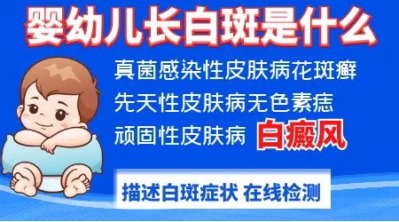 四个月宝宝有白癜风可以照308激光吗？”