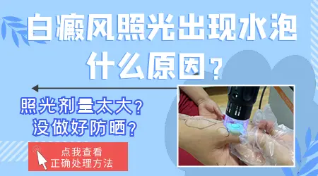 孩子吃药治白癜风，这些潜在危害你知道吗？