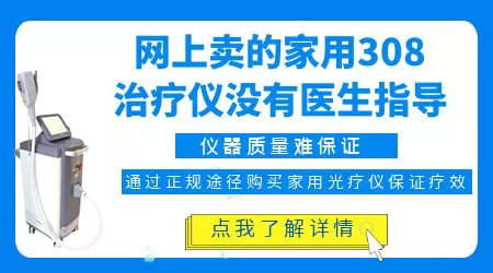 孩子小有白癜风怎么治”