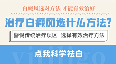 治疗孩子白癜风的方法有哪些