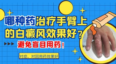 如何有效治疗儿童白癜风？”