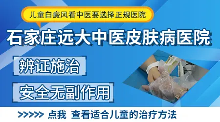 白癜风是否会遗传给下一代？科学解答与日常关怀