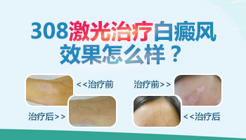 小孩照完308激光白斑位置发红是怎么回事”