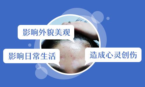 儿童胸腹部白癜风面积不大，如何科学治疗？”