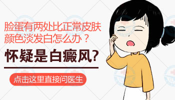 白癜风白点图